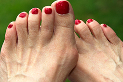 Bunions Hammertoes Forefoot Deformities Medstar Health