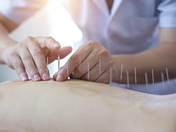 Acupuncture with Electric Stimulation - Acupuncture & Physical Therapy  Specialist